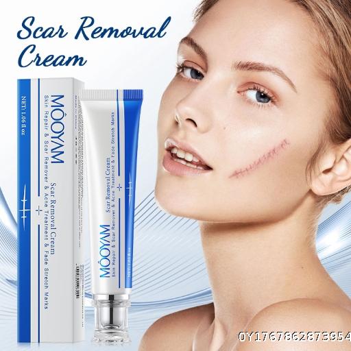 Cross border Scarrepairingremoving face cream wholesale Scarcream