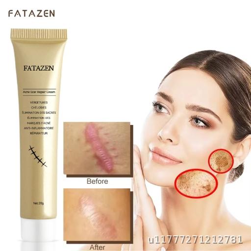  Scar Whitening Ointment, Cesarean Section, Pregnancy Scar, Burn Repair, Soothing Gel, Acne Mark Removal Ointment, In Stock